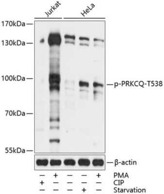 Western Blot: PKC theta [p Thr538] AntibodyAzide and BSA Free [NBP3-05454]